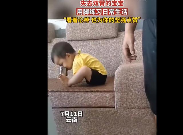 失去双臂的宝宝，用脚练习日常生活技巧，网友：看着心里难受