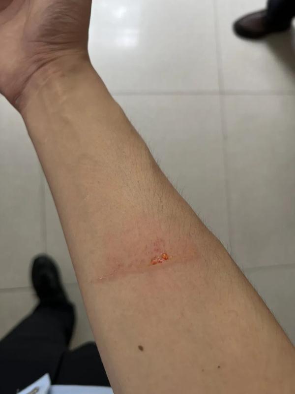 负气男子欲11楼跳下 民警火速拦腰抱住