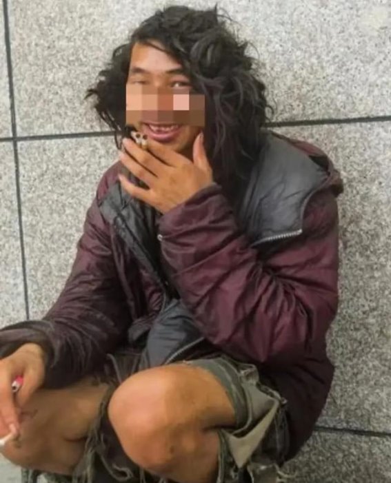 为啥乞丐头发多上班族却掉发？答案在这里