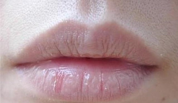 肺虚的四个常见表现，赶紧关注你的肺部健康