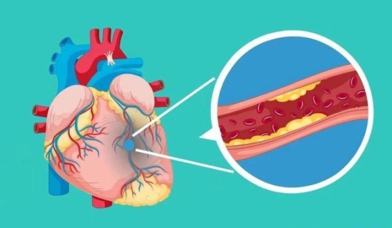 无症状高血压：潜藏的健康隐患