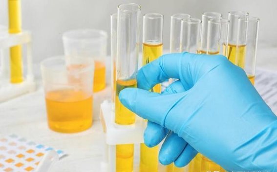 60岁后排尿习惯的变化，可能意味着什么？