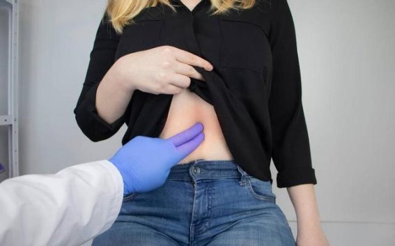 胆囊炎的早期信号，您可能错过的身体警报