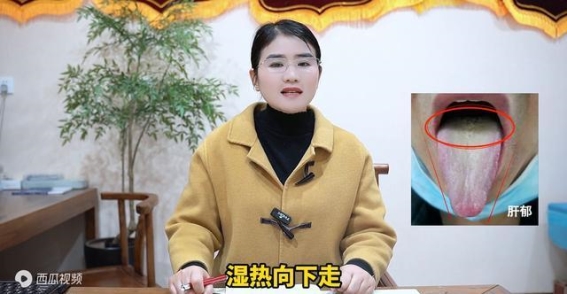 五毒俱全的舌象：阳虚、湿热、肝郁、气滞如何影响房事健康