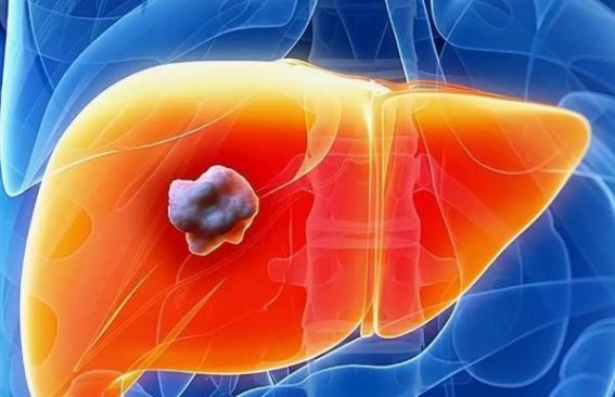 大蒜对肝有害吗？医生建议：想肝好，避免这三样，吃这两种水果