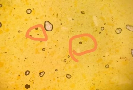 生吃猪肉、牛肉可能得带绦虫病