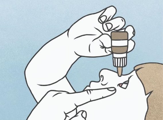 乱滴眼药水导致失明，眼部自我治疗的危险