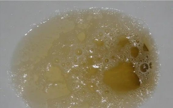 肾不好的人，身体这3处会报信