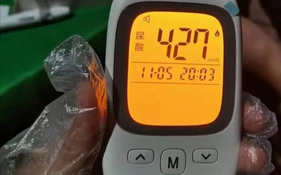 高尿酸不等于痛风，如何判断关节是否受损