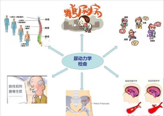潢川县人民医院引进全球先进尿动力检查设备，推动膀胱功能障碍精准治疗
