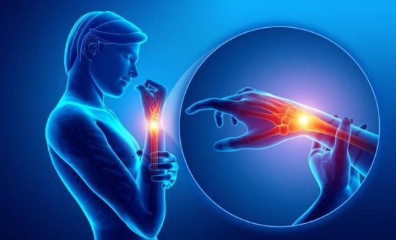 关节炎与痛风的辨别技巧，这五个要点让你更清晰