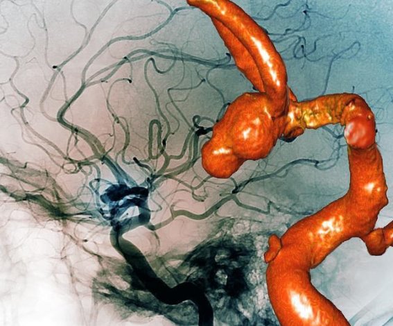 全球变暖：地球的紧急信号