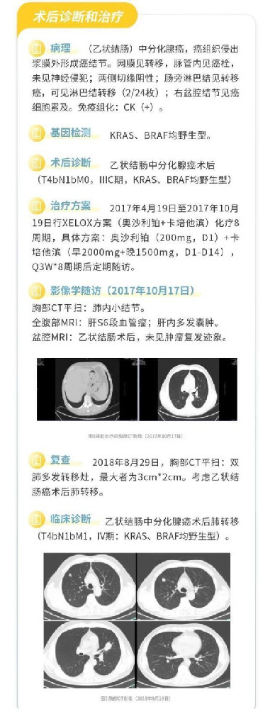 抗血管生成治疗点亮结直肠癌三线及以上治疗患者的生存希望